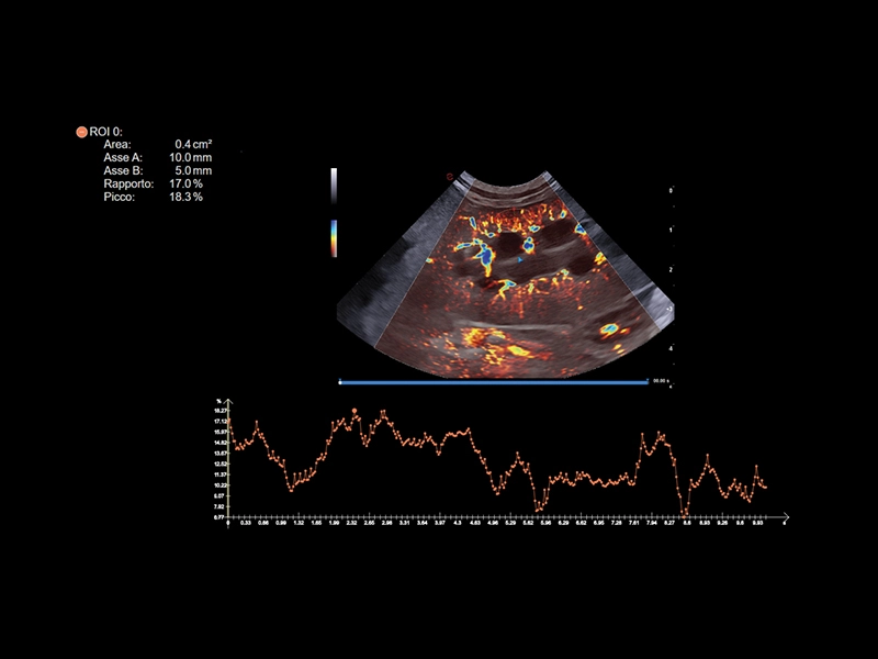 csm_MyLab™Panther_-_Dog_-_kidney_vascularization_quantification_-_microV_and_QPack